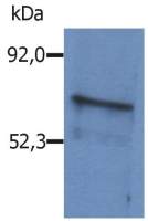 BLNK antibody