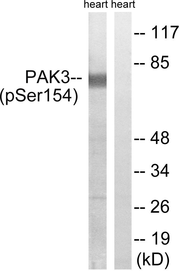 PAK3 (phospho Ser154) antibody