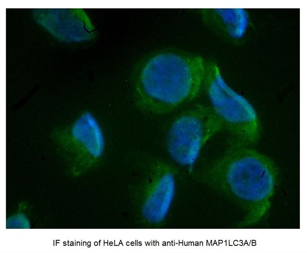 LC3A/B antibody, N-term