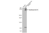Apolipoprotein B antibody