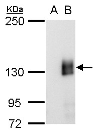 mCherry antibody [GT857]