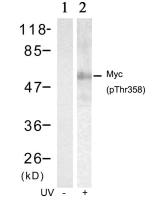 c-Myc (phospho Thr358) antibody
