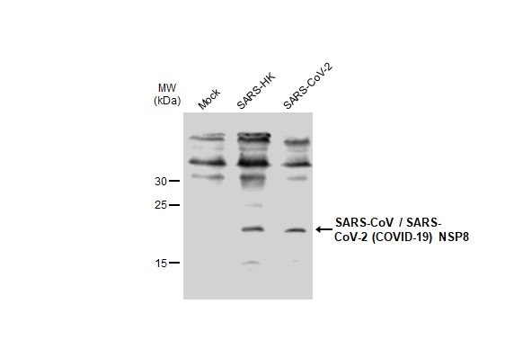 SARS-CoV / SARS-CoV-2 (COVID-19) nsp8 antibody [5A10]
