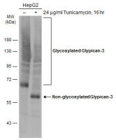 Glypican-3 antibody [GT764]