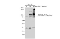 MERS-CoV Spike (S1) antibody