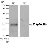 p53 (phospho Ser46) antibody