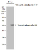 Vimentin (phospho Ser56) antibody [GT11512]