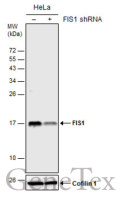 FIS1 antibody [GT12112]