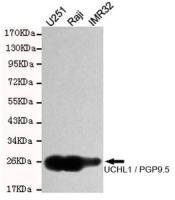 PGP9.5 antibody [7B8-G5-E7]