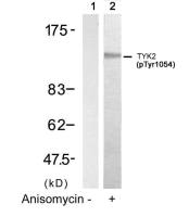 TYK2 (phospho Tyr1054) antibody