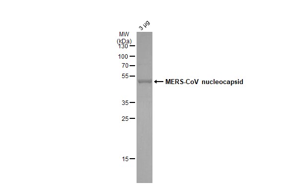 MERS-CoV Nucleocapsid protein, DDDDK tag