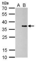 COL11A2 antibody [GT473]