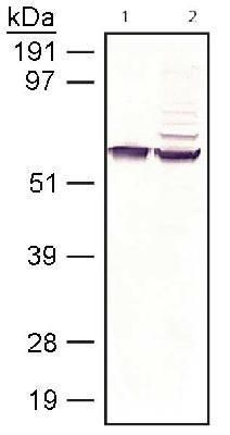 RPE65 antibody [401.8B11.3D9]