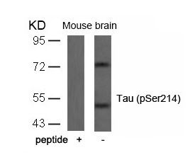 Tau (phospho Ser214) antibody