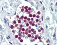 GM-CSF Receptor alpha antibody