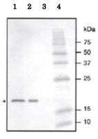 Streptococcus NADase Inhibitor antibody