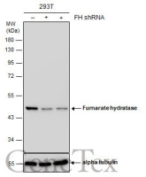 Fumarate hydratase antibody [GT7612]