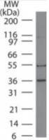 MITF antibody [21D1418]