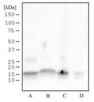 Histone H3S28ph (phospho Ser28) antibody [117C826]