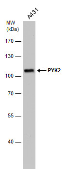PYK2 antibody [GT1132]