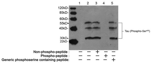 Tau (phospho Ser400) antibody