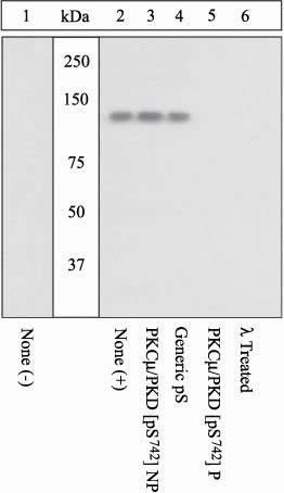 PKC mu (phospho Ser742) antibody