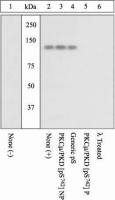 PKC mu (phospho Ser742) antibody