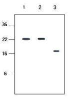 KIR2D antibody [2H6]