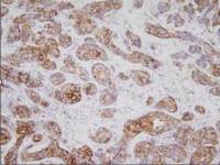 TPD52L1 antibody [d1C5]