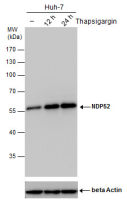 NDP52 antibody [GT1813]