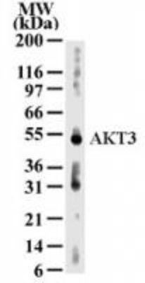 AKT3 antibody [66C1247]