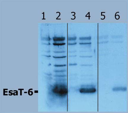 Mycobacterium tuberculosis ESAT6 antibody