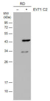 Enterovirus 71 VP1 antibody [GT9512]