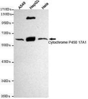 CYP17A1 antibody [6E1-H9-F6]