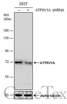 ATP6V1A antibody [GT3846]