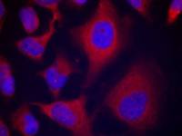 alpha Adducin (phospho Ser726) antibody