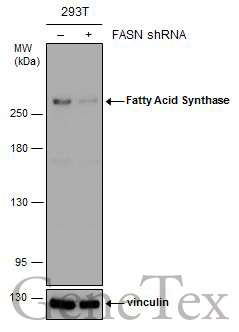 Fatty Acid Synthase antibody [GT556]
