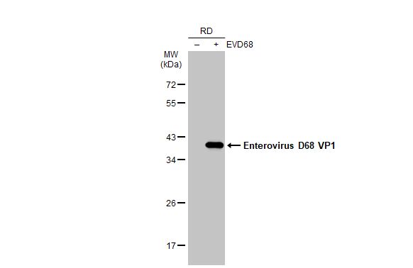 Enterovirus D68 VP1 antibody [GT1843]