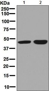 CABP1 antibody [EPR7916]