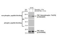 PKC theta (phospho Thr219) antibody [HL1157]