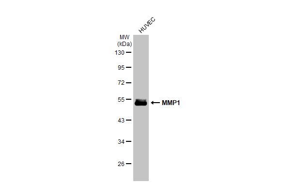 MMP1 antibody [HL1259]