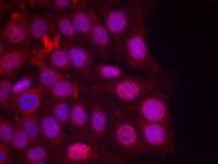 Progesterone Receptor (phospho Ser190) antibody