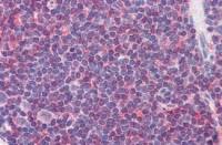 IL7 Receptor alpha (phospho Tyr449) antibody