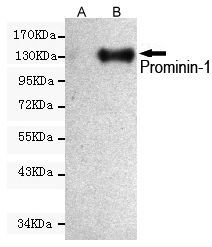 CD133 antibody [6H10-F1-C11]
