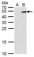 IL28B antibody [GT2512]