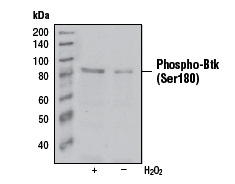 BTK (phospho Ser180) antibody [3i5(3D3)]