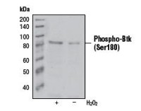 BTK (phospho Ser180) antibody [3i5(3D3)]