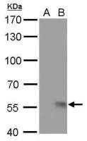 Influenza A virus H1N1 NA (Neuraminidase) antibody [GT172]