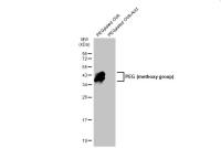 PEG (methoxy group) antibody [HL1020]