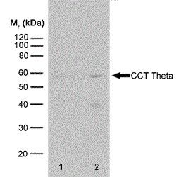 TCP1 theta antibody [PK/13/72/8k]